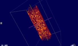 Figura Curso 5 - Fundamentos da ressonância magnética nuclear e suas aplicações em imagens (MRI) -Ivan S. Oliveira